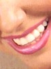 Remedio natural curativo para blanquear dientes