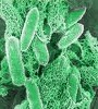 Enfermedades producidas por alimentos contaminados