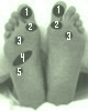 Qué puntos masajear en cada caso