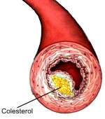 Nivel correcto del valor de colesterol en la sangre