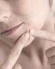 Porqué aparecen las espinillas en el rostro