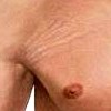 �A los hombres les salen estr�as?