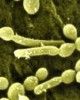 Cuáles son los síntomas de la candidiasis genital