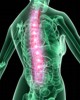 Causas del dolor de espalda