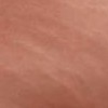 Qu� remedio sirve para las estr�as