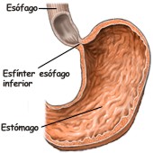¿Qué es acalasia esofágica?