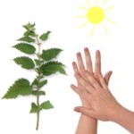 Qu� es la fitodermatitis