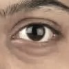 C�mo puedo mejorar mis ojos hinchados