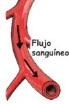 Concepto de qué es estasis