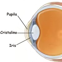 Consejos para no sufrir de cataratas