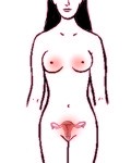 Ubicaci�n de los fibromas en la mujer