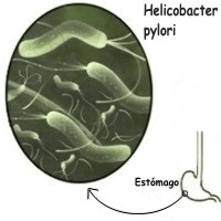 Como es la bacteria Helicobacter pylori