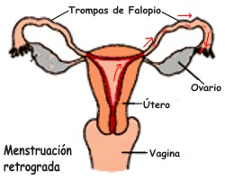 Qu� es menstruaci�n retrograda