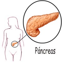 Como es la pancreatitis crónica