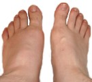 Porque raz�n se hinchan los pies en las personas mayores