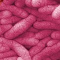 Consejos para no sufrir el contagio por salmonella