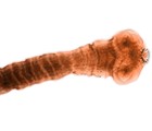 Signos y cómo se manifiesta la teniasis