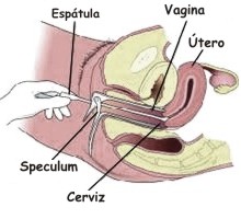 Para qu se usa el espculo vaginal?