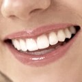 Razones del aflojamiento de los dientes